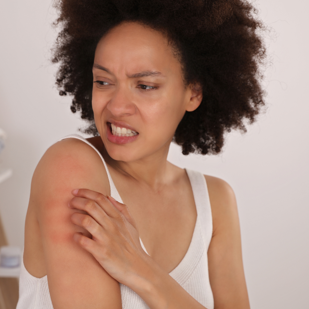 Dead Sea Salt for Eczema & Psoriasis